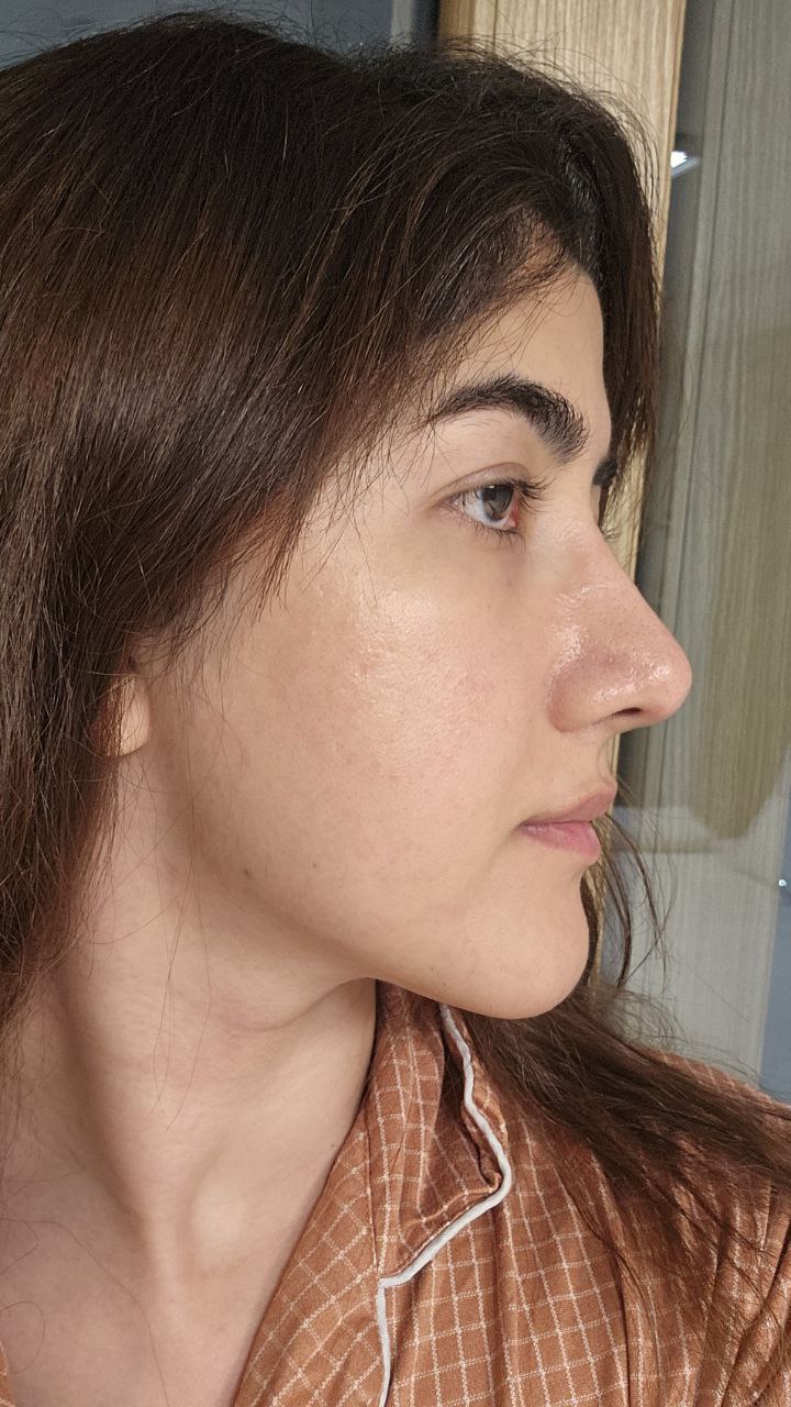نیم‌رخ راست