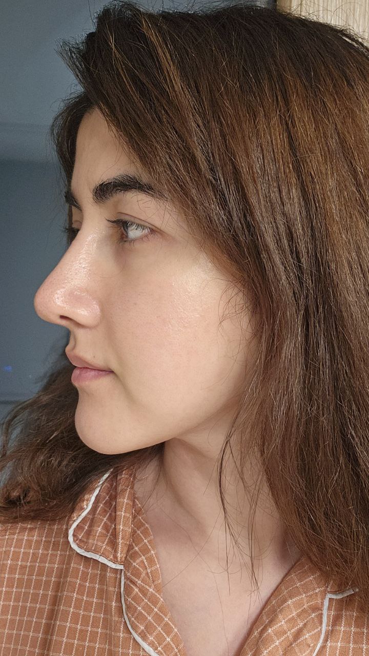 نیم‌رخ چپ
